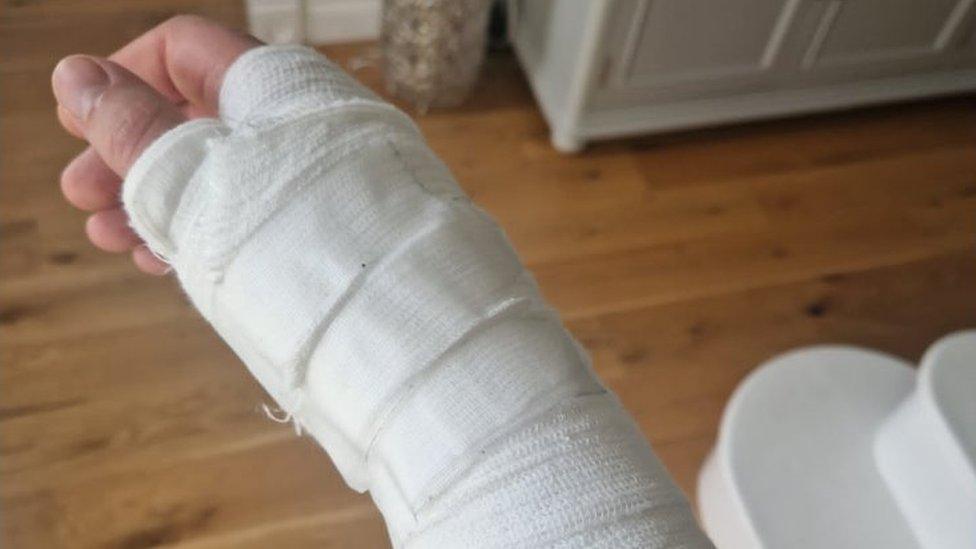 Injured hand