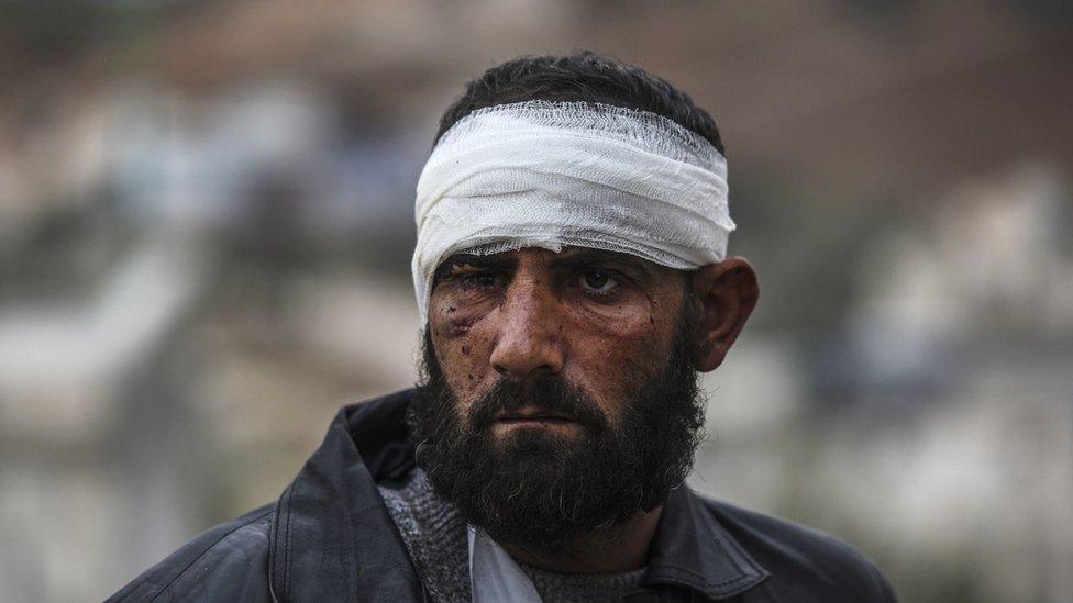 An injured Syrian man near the Turkish border, 16 December