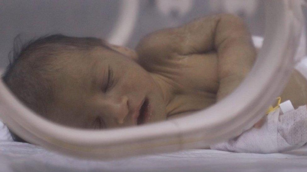 Adnan, a baby rescued from the rubble of his home in north-western Syria, sleeps inside an incubator at al-Shifa Hospital in Afrin (13 February 2023)