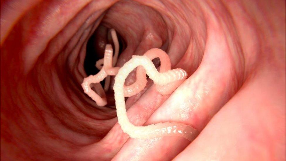 Tapeworm