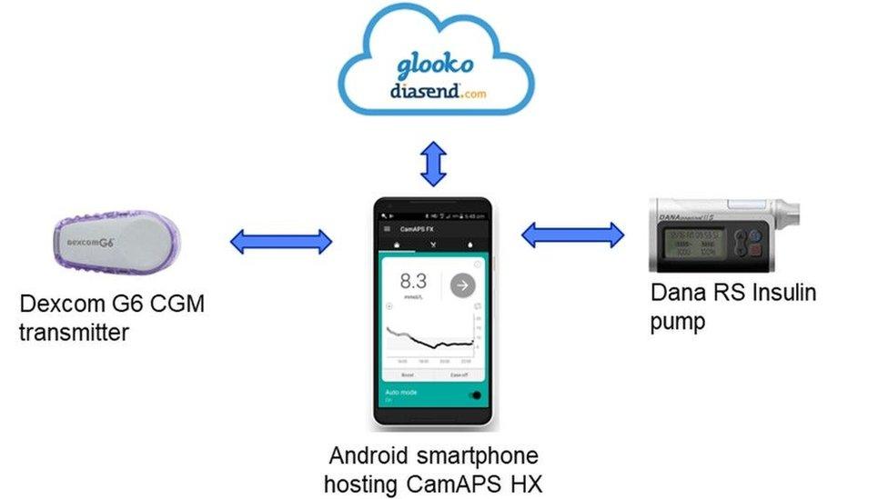 Artificial pancreas diagram