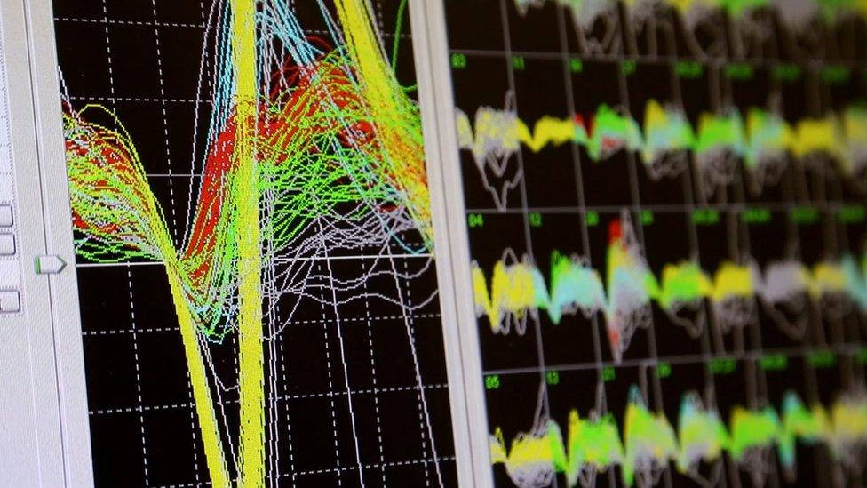 brain wave recordings on computer screen