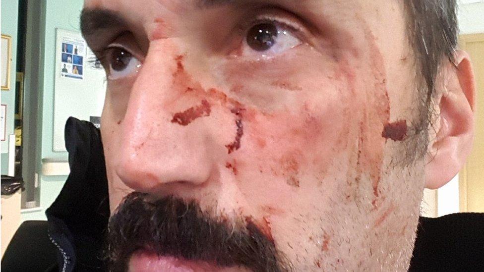 Dimitris Legakis with injuries to his face after the attack