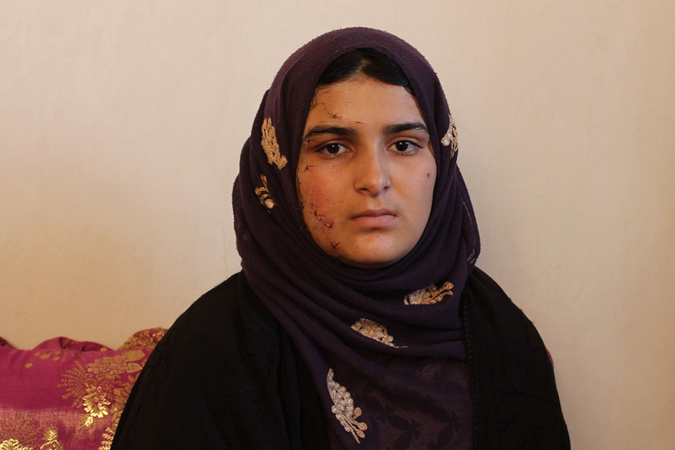 Razia survived the car bomb detonated next to her sign language school