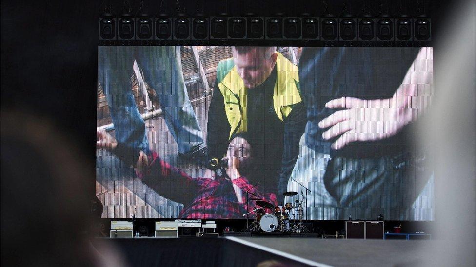 Screen footage of Dave Grohl after falling from stage in Gothenburg