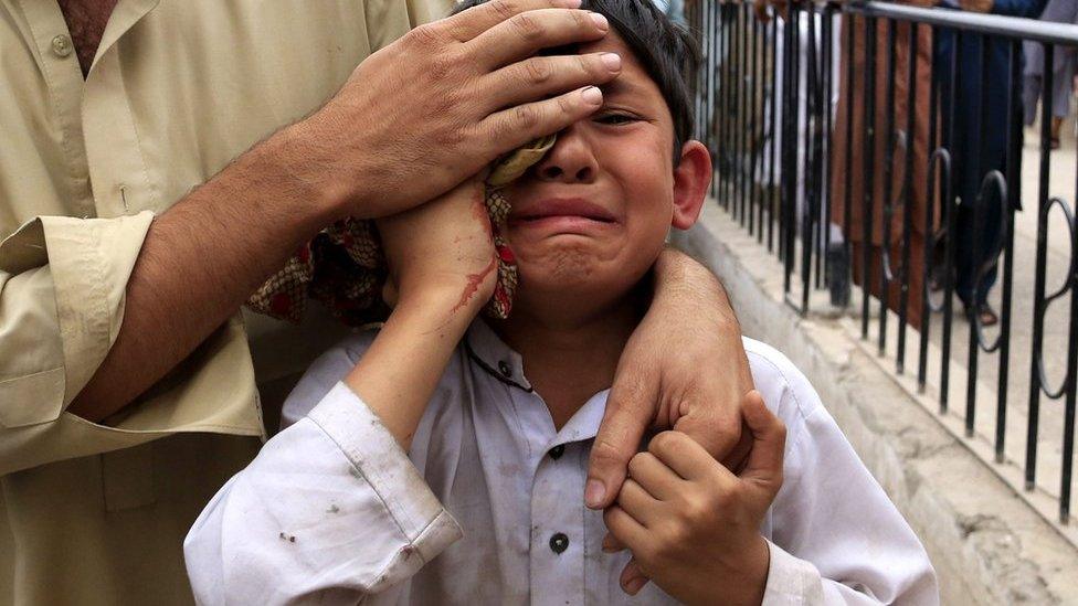 A boy who was injured in an earthquake cries outside a hospital in Peshawar, Pakistan, 10 April 2016