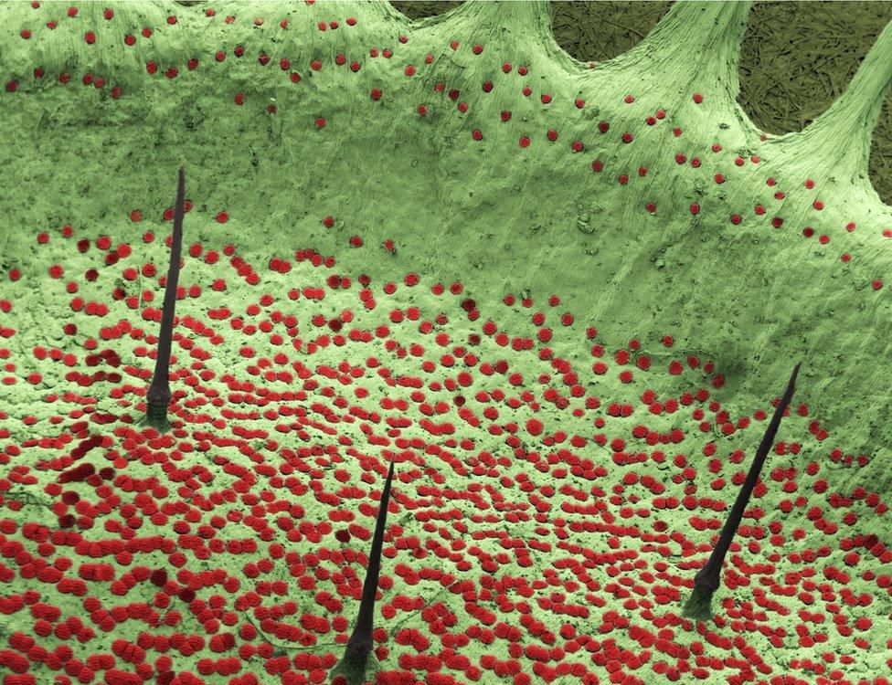 microscopic view of trigger hairs