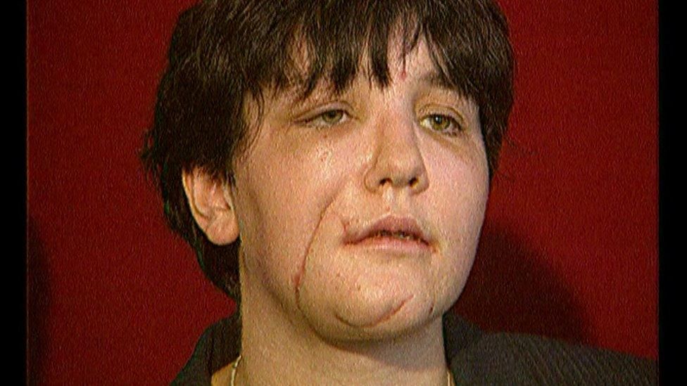 Julie Cooper pictured in 2000 following the attack