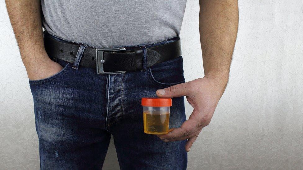 Man holding a urine sample