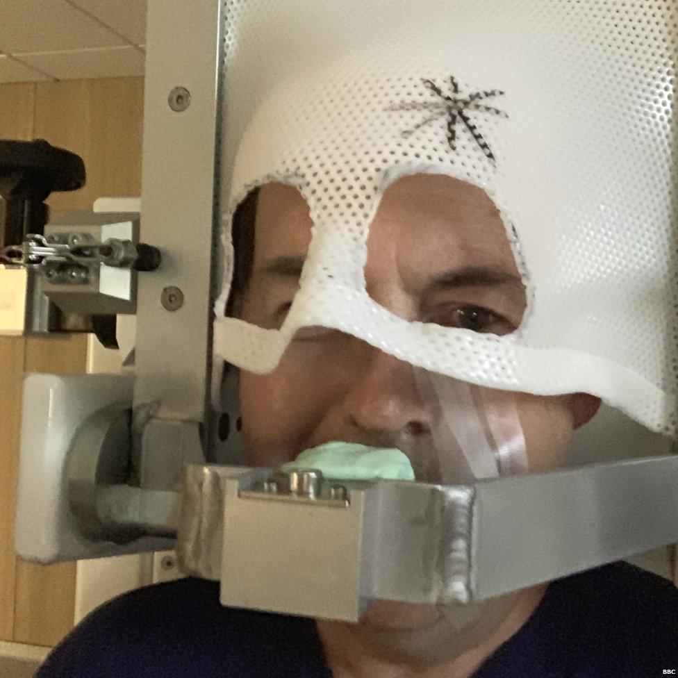 Rory Cellan-Jones in an eye cancer mask