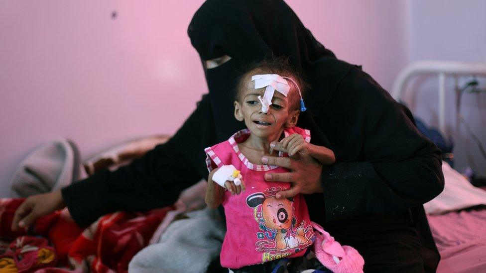 File photo showing a woman holding her malnourished daughter at a malnutrition treatment ward of al-Sabeen hospital in Sanaa, Yemen October 27, 2020