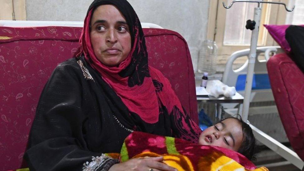 Heeba, a 20-month old baby girl, is held by her mother Masarat on a hospital bed in Srinagar on November 26, 2018, after being shot in her right eye by lead pellets by Indian government forces.