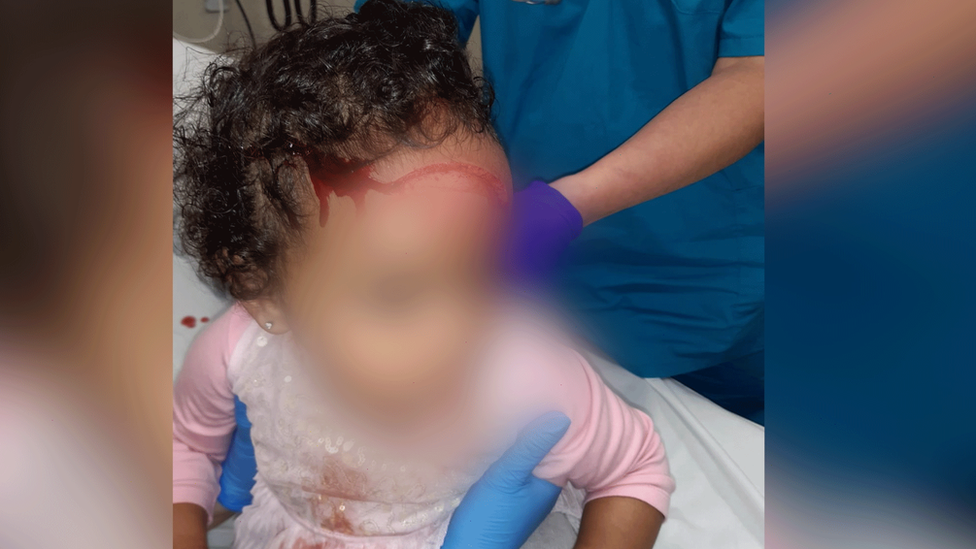 A toddler in hospital after a ceiling collapse