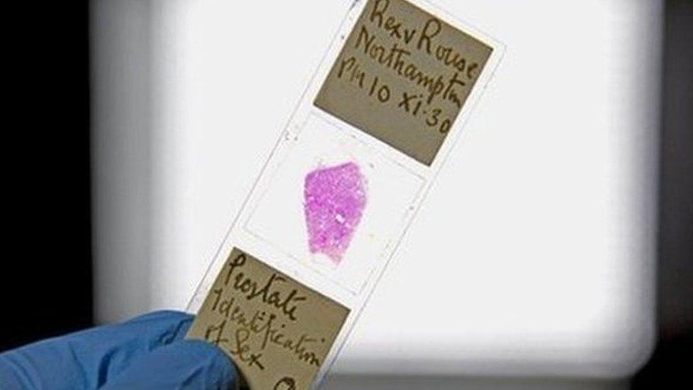 Slide containing tissue sample from Alfred Rouse's victim