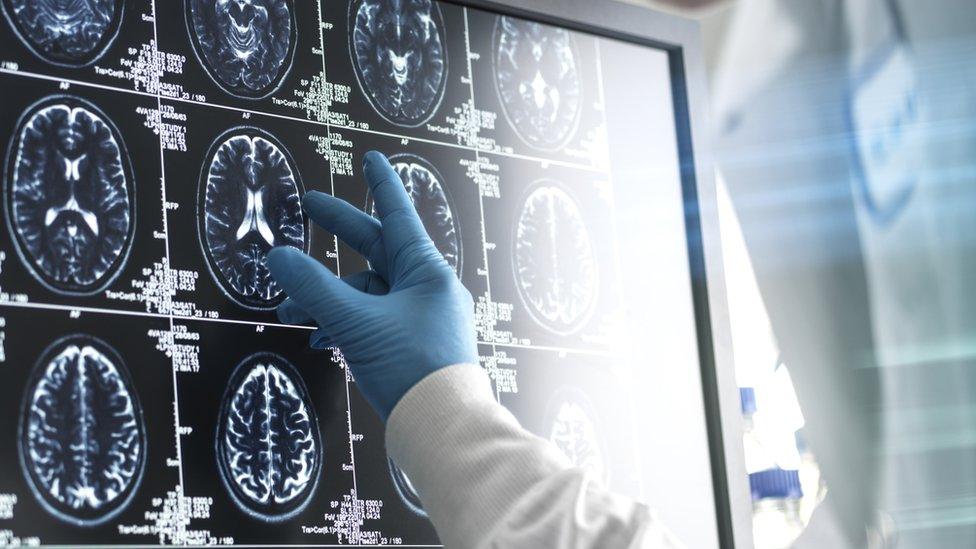 Doctor analysing patients brain scan on screen - stock photo