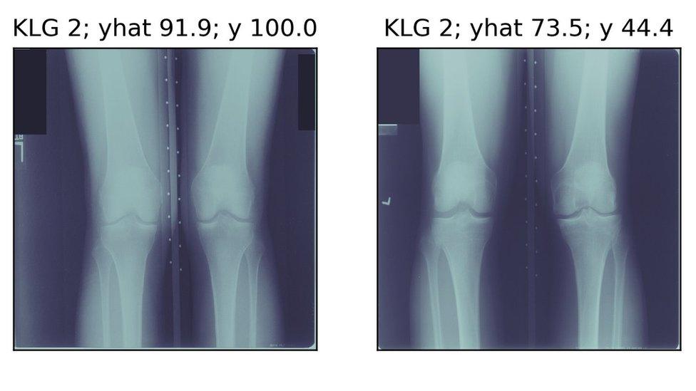 X-ray