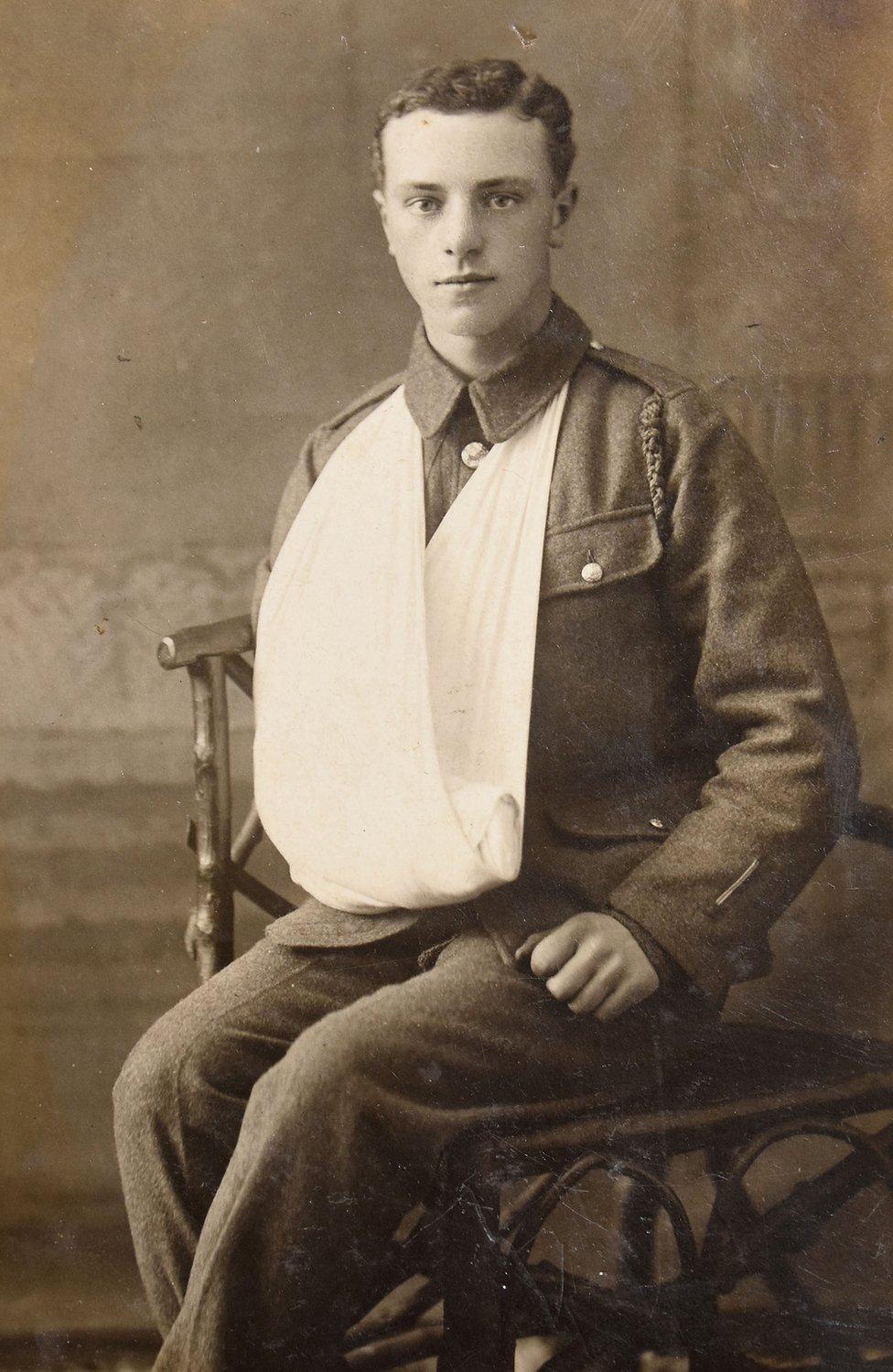 Cpl Tommy Crawford, of the 15th Battalion DLI, with a sling after being struck with a bayonet