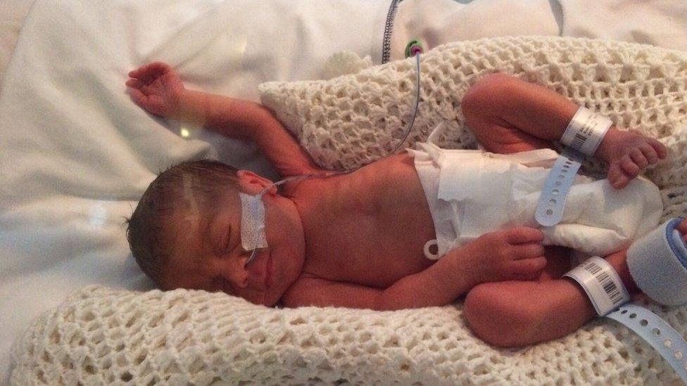 Seth was born nine weeks early