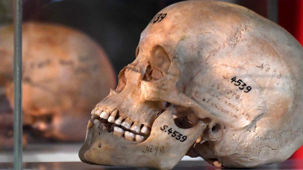 Skull in an exhibition case with markings on it