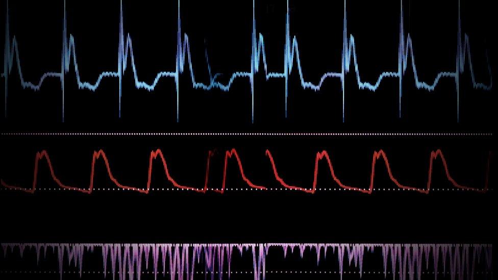 screen medical monitor