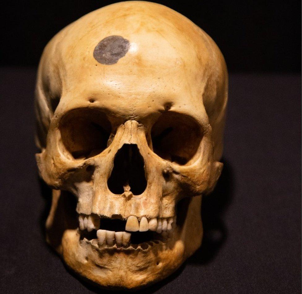 Henry’s actual skull