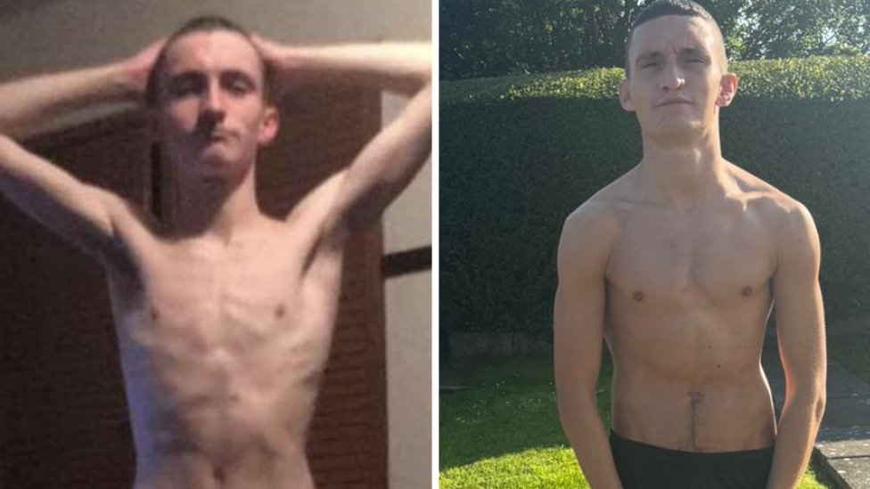 A side-by-side comparison of Ethan. In both he is wearing no top, with his torso exposed. In the left photo, Ethan appears very thin, with ribs prominent. He estimates he weighs about seven stone, or 44 kilos in the image. He is posing with his arms up, and his hands placed on the top of his head. The image is grainy. The image was taken while he was using ketamine. In the second right image, Ethan is looking more muscular, with more defined chest muscles. He estimates he weights 10.5 stone in this image. His hands are by his side, and he is outside, stood on grass with a large hedge in shadow behind him. The image is after going to rehab. In both pictures he has very short cropped black hair and is clean shaven.