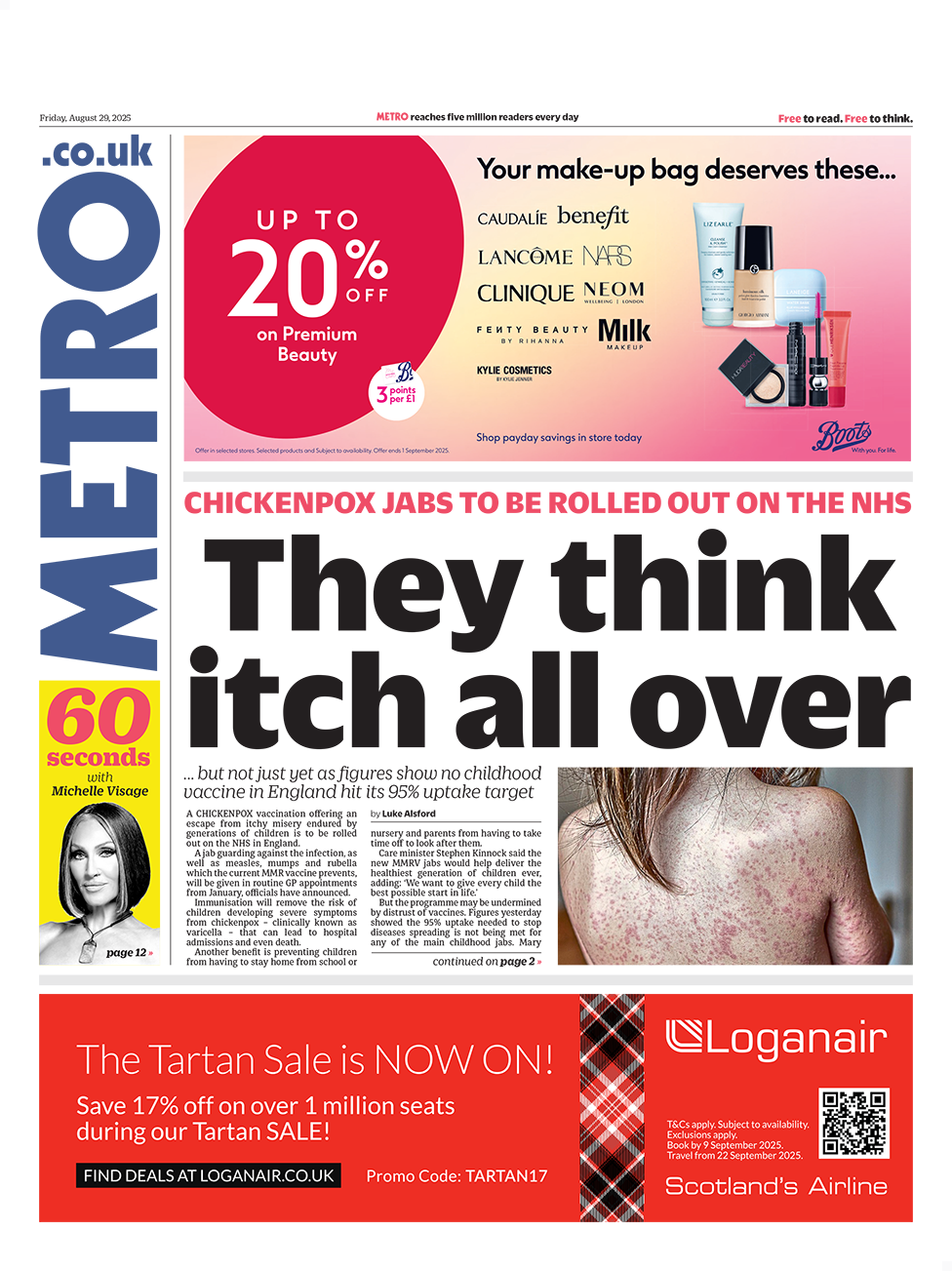 Metro front page. There's a picture of a child with a severe chickenpox rash and the headline "they think itch all over".
