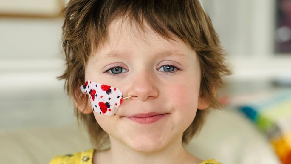 Annabel Ashmore. The five-year-old has short brown hair and blue eyes. She has a tube running to her nose which is covered with a plaster decorated with ladybirds.