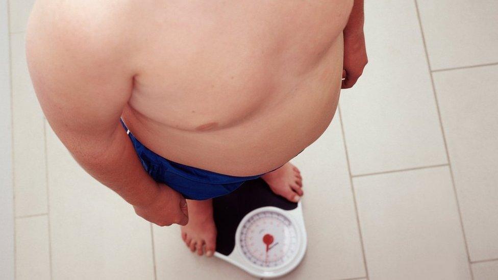 An overweight child stands on scales