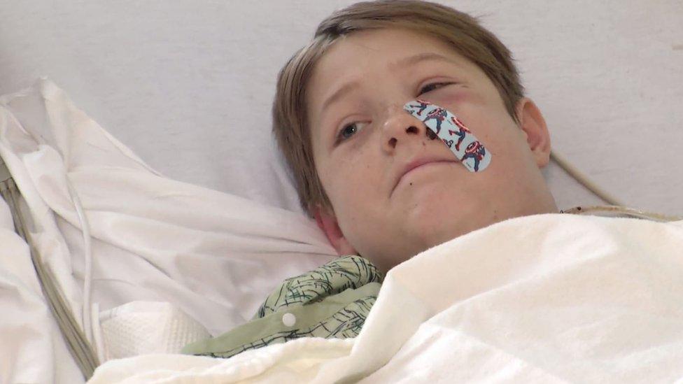 Young boy in hospital with bandage over cheek