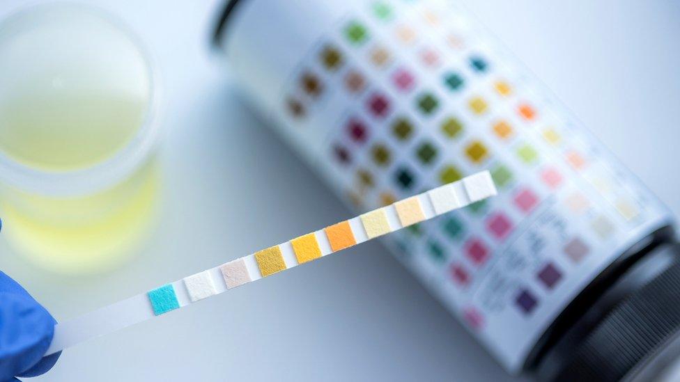 Urine test generic