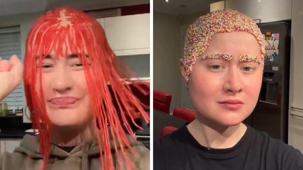 Two pictures of Shell Rowe's head with confectionary on her hairless scalp - one with red bootlace sweets; the other with multicoloured sprinkles, which also create eyebrows