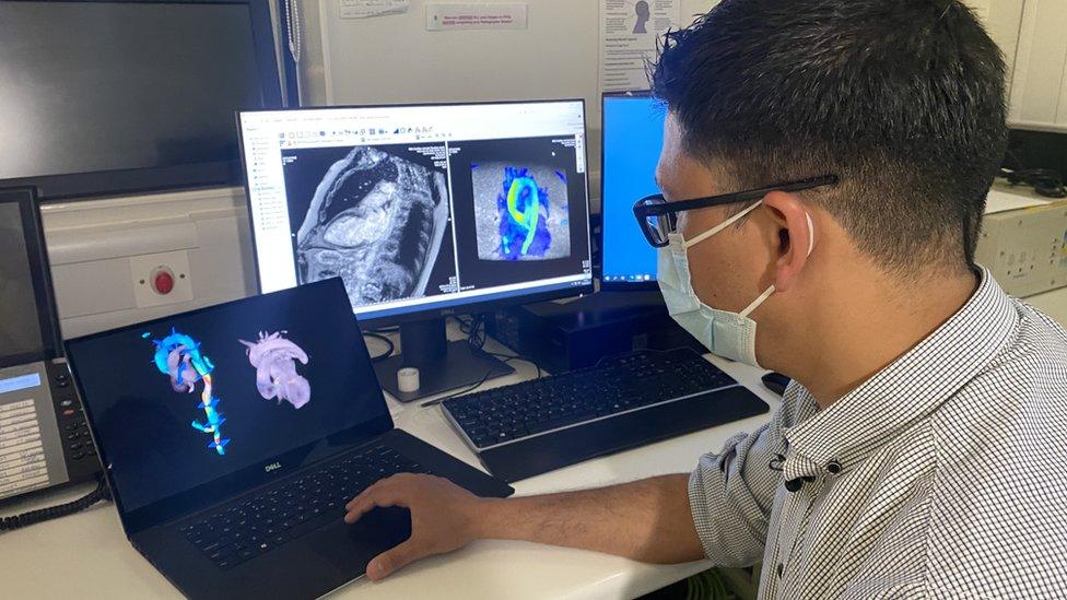 Norfolk and Norwich University Hospital staff with 4D heart scan