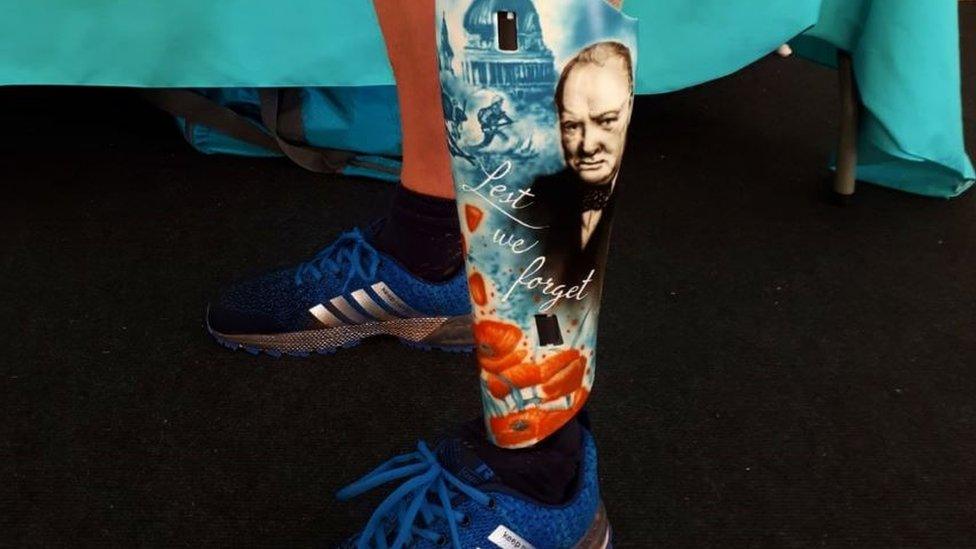 A prosthetic leg with a painted design of Winston Churchill, some poppies and the words Lest We Forget