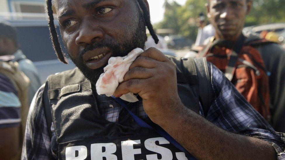 Photojournalist Chery Dieu-Nalio holds a gauze next to his mouth