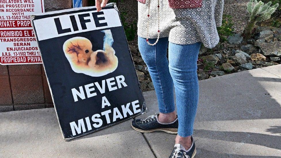 A woman holds a sign reading: "Life: Never a mistake"