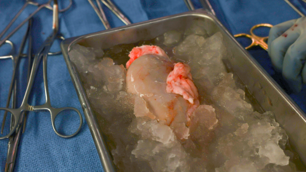 Pig kidney on ice