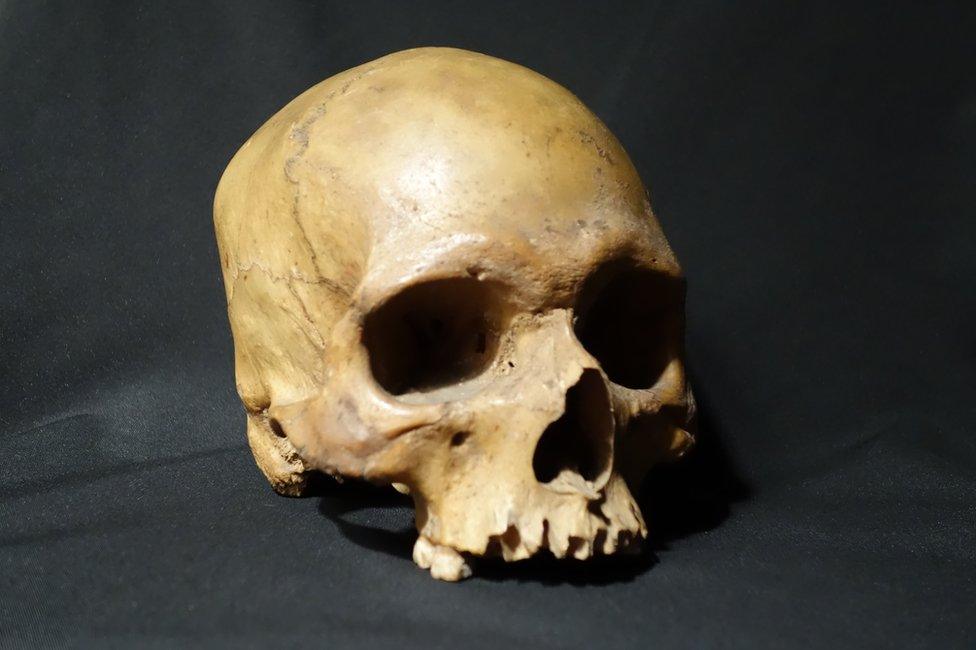 The skull of a 32-year-old Indian soldier who revolted against the British