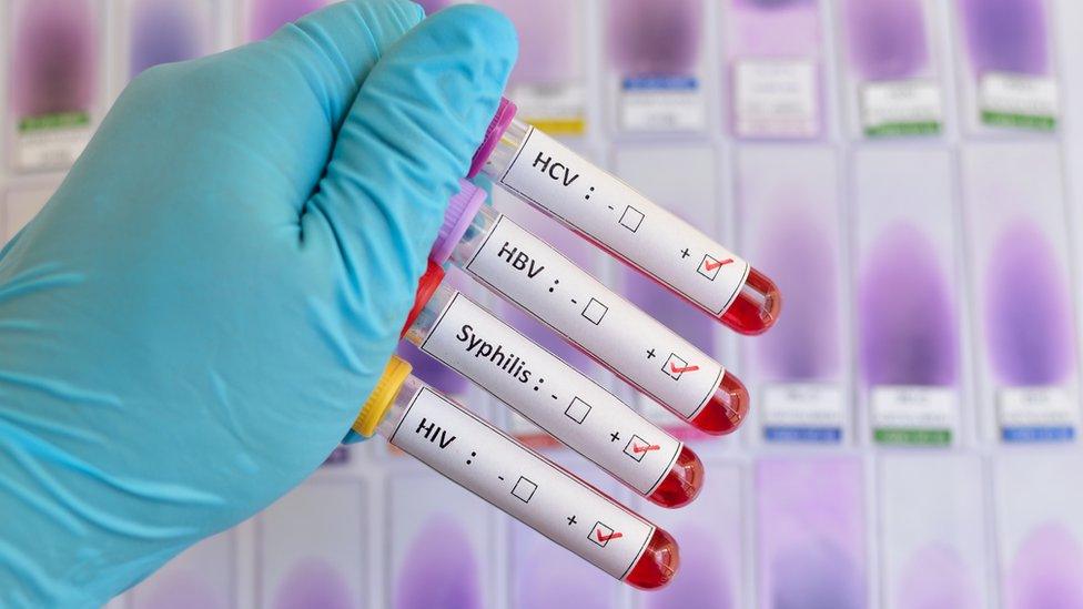 A photograph of a person in rubber gloves holding up four tubes containing blood specimens. The containers have labels reading HCV, HBV, Syphillis and HIV