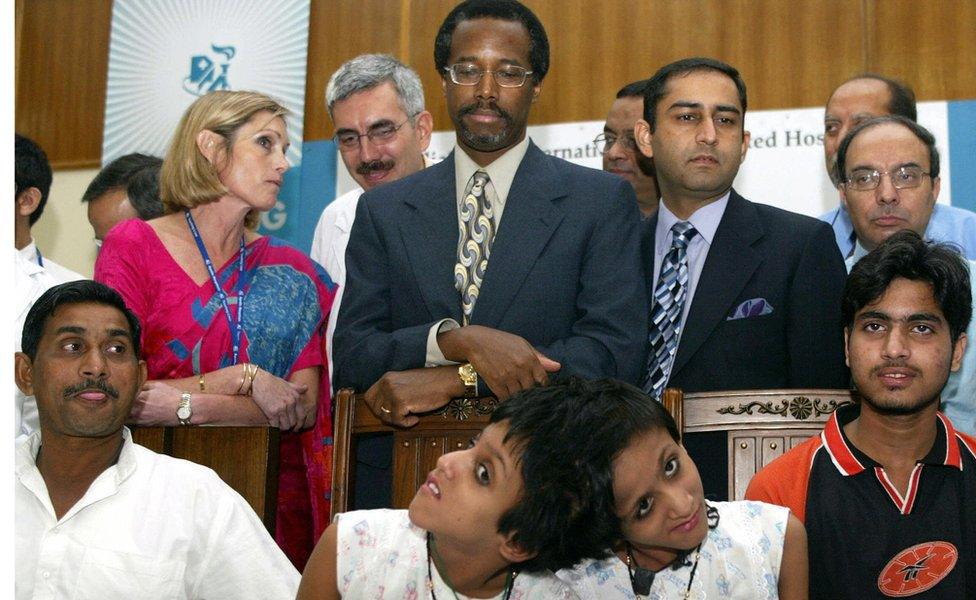 Ten-year-old Indian twins Sabah (bottom2L) and Farah sit beside US neurosurgeon Benjamin Carson (C), during a press conference at the Indraprashtra Apollo Hospital in New Delhi, 04 October 2005