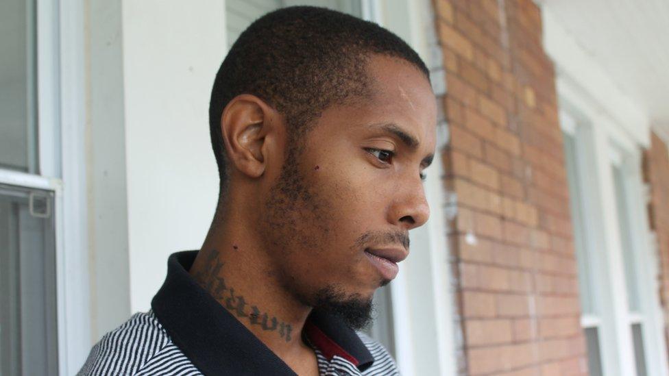 Devrone McKnight still has pieces of bullets embedded in his cheek and neck