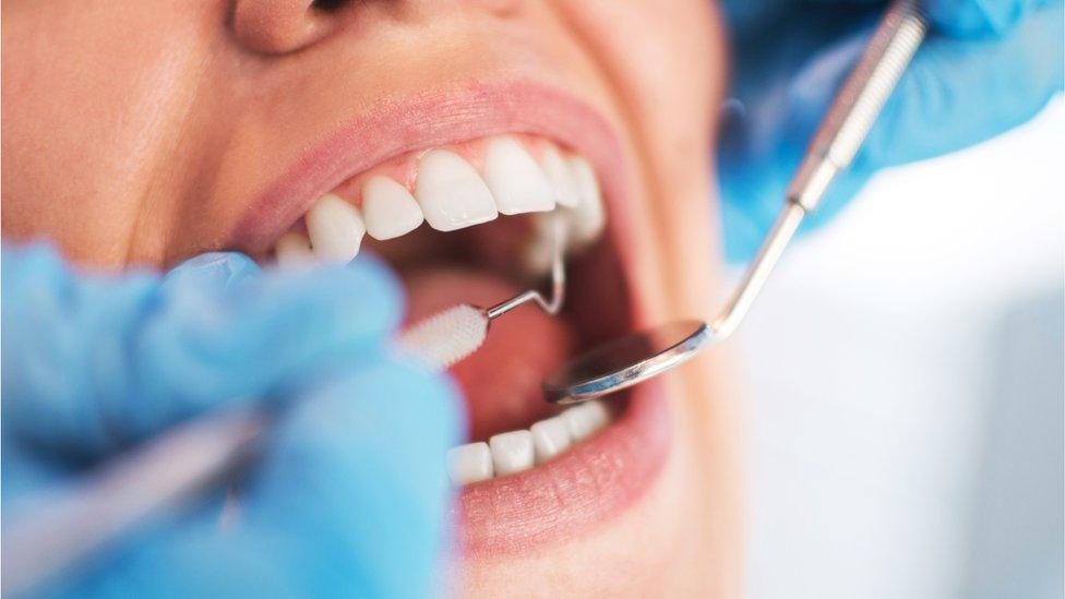 Open female mouth during oral checkup at the dentist. Selective - stock photo