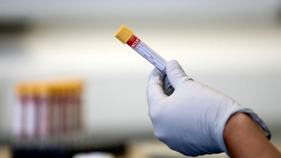 Close up of gloved hand holding a blood sample