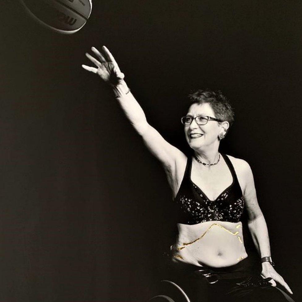 A black and white image of Fiona Carey, photographed playing wheelchair basketball, with her scars filled in with gold leaf