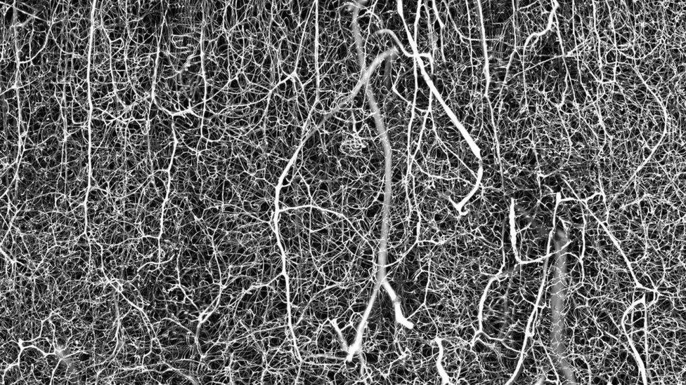 vasculature of an adult mouse brain