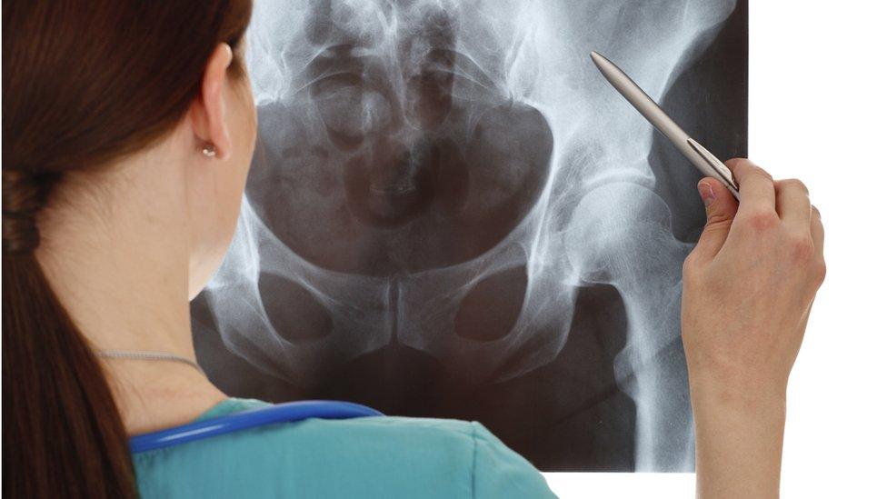 Doctor examining X-ray image