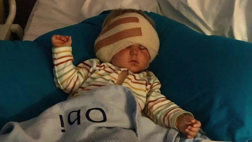 small child in hospital with bandage on head