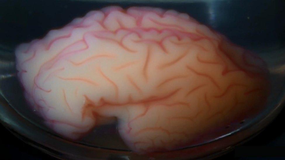 gel brain in a jar