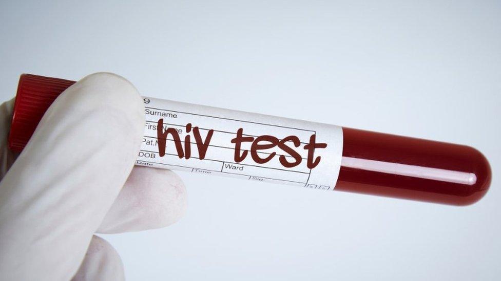 HIV test