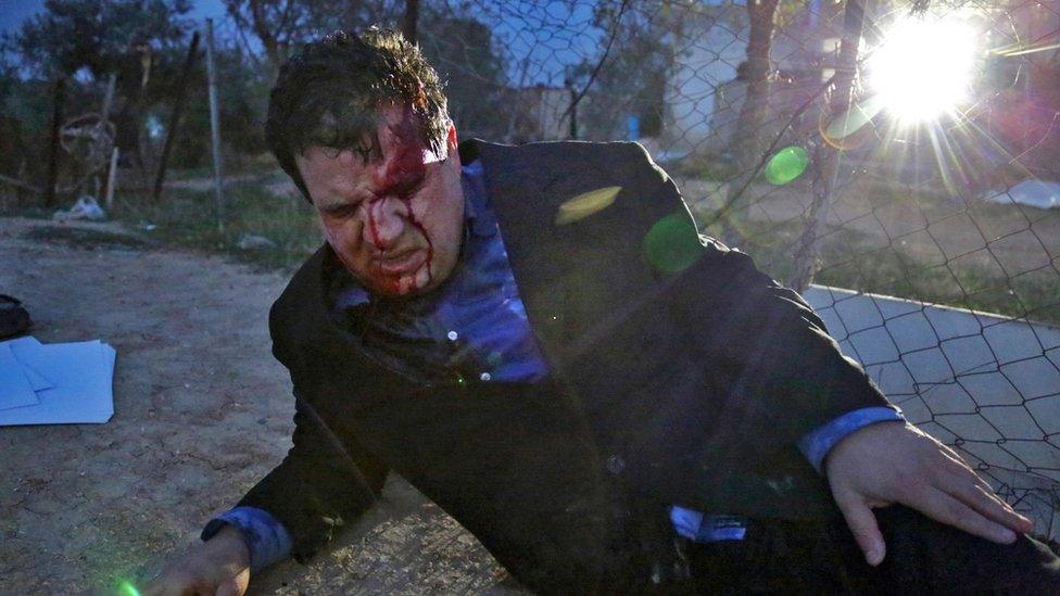 Ayman Odeh lies on the ground after being injured during clashes with Israeli police in Umm al-Hiran (18 January 2017)